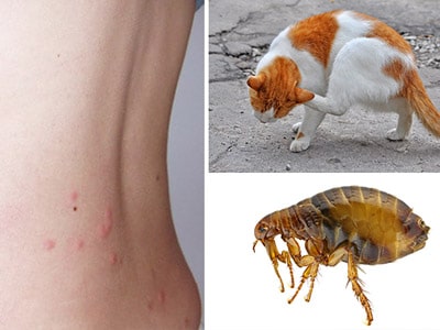 Can Humans Get Fleas From Dogs And Cats?