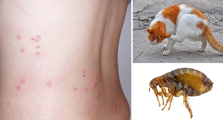 Can Humans Get Fleas From Dogs And Cats?